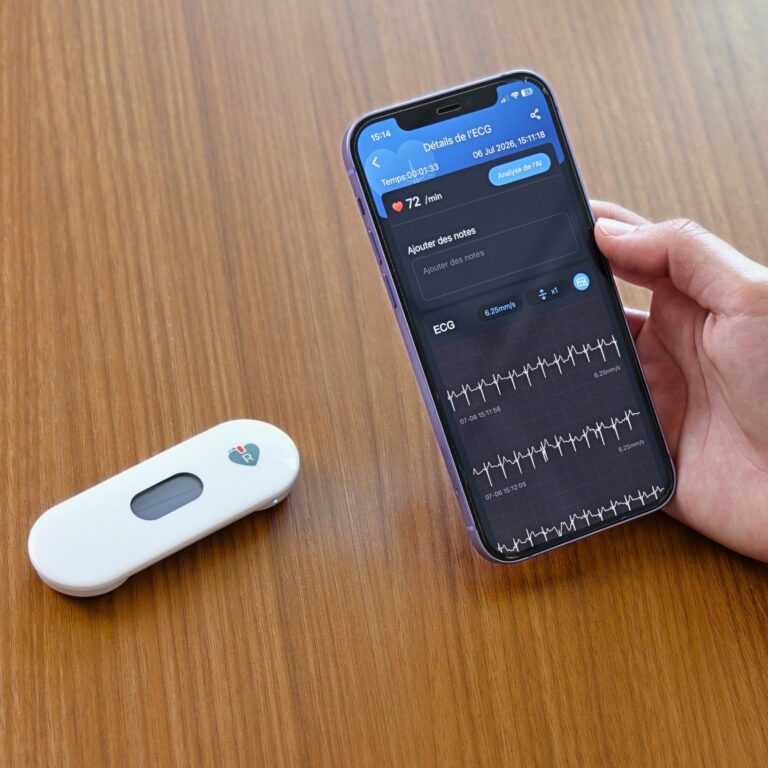 My Cardiomate Spengler – Pocket ECG | Bluetooth